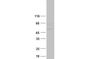 Validation with Western Blot
