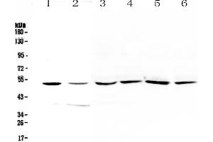 Western blot analysis of HGD using anti-HGD antibody . (HGD anticorps  (AA 374-445))
