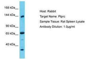 Image no. 1 for anti-Protein tyrosine Phosphatase, Receptor Type, C (PTPRC) (AA 551-600) antibody (ABIN6750409)