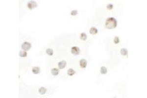 Immunocytochemistry of WDR5 in 293 cells with WDR5 antibody at 5 ug/mL.