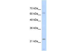 WB Suggested Anti-TNNI1 Antibody Titration:  2. (TNNI1 anticorps  (Middle Region))
