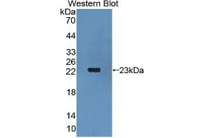 Western Blotting (WB) image for anti-Gremlin 1 (GREM1) antibody (Biotin) (ABIN1175538) (GREM1 anticorps  (Biotin))
