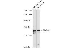 Western blot analysis of extracts of various cell lines, using FBXO31 antibody (ABIN6129682, ABIN6140518, ABIN6140519 and ABIN6216685) at 1:3000 dilution. (FBXO31 anticorps  (AA 240-539))