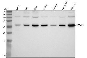 anti-Mast Cell Expressed Membrane Protein 1 (MCEMP1) (AA 1-183) antibody