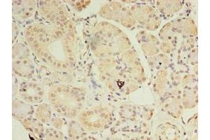 Immunohistochemistry of paraffin-embedded human pancreatic tissue using ABIN7144199 at dilution of 1:100 (ASB8 anticorps  (AA 12-288))