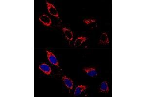 Confocal immunofluorescence analysis of U-2OS cells using  antibody  at dilution of 1:200.