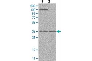Western blot analysis of Lane 1: Human cell line RT-4 Lane 2: Human cell line U-251MG sp with PVRL1 polyclonal antibody  at 1:100-1:250 dilution. (PVRL1 anticorps)