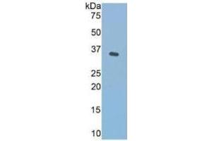 WB of Protein Standard: different control antibodies against Highly purified E. (Fibronectin Kit CLIA)