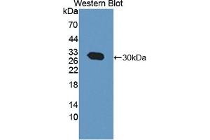 Detection of Recombinant CACYBP, Human using Polyclonal Antibody to Calcyclin Binding Protein (CACYBP) (CACYBP anticorps  (AA 2-228))