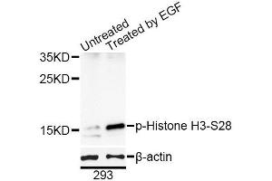 Western blot analysis of extracts of 293T cells, using Phospho-Histone H3-S28 antibody (ABIN5969937) at 1/1000 dilution. (Histone H3.1 anticorps  (pSer29))