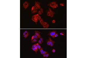 Immunofluorescence analysis of MCF7 cells using SLC7 Rabbit pAb (ABIN3016800, ABIN3016801, ABIN1682793 and ABIN6219842) at dilution of 1:300 (40x lens). (SLC7A5 anticorps  (AA 1-125))