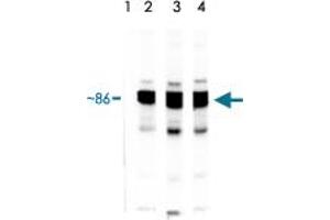 Lane 1 : HSP90 protein standard stressgen. (HSP90 alpha/beta anticorps)