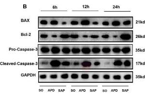 APD treatment enhances pancreatic acinar cell apoptosis in SAP rats.