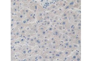 Used in DAB staining on fromalin fixed paraffin- embedded Kidney tissue