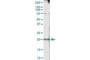 Immunoprecipitation of CETN1 transfected lysate using anti-CETN1 MaxPab rabbit polyclonal antibody and Protein A Magnetic Bead , and immunoblotted with CETN1 purified MaxPab mouse polyclonal antibody (B01P) .