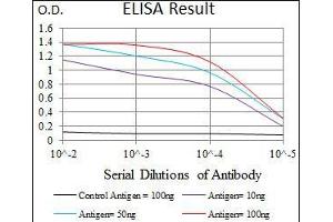 Black line: Control Antigen (100 ng), Purple line: Antigen(10 ng), Blue line: Antigen (50 ng), Red line: Antigen (100 ng), (ILK anticorps  (AA 97-244))