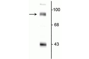 Western blot of rat hippocampal lysate showing specific immunolabeling of the ~95 kDa PSD-95 protein. (DLG4 anticorps  (N-Term))