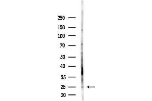 Western blot analysis of lysates from HepG2 cells(LPS, 4h treatment), using NOL12 Antibody at 1/1000 dilution.