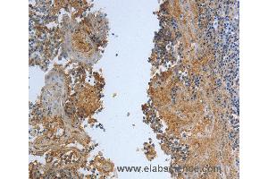Immunohistochemistry of Human tonsil  using DLG4 Polyclonal Antibody at dilution of 1:30 (DLG4 anticorps)