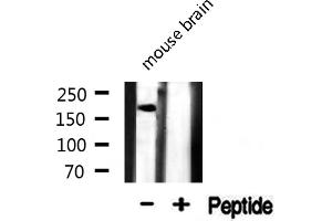 Western blot analysis of MAP 2 expression in Mouse brain lysate