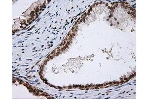 Immunohistochemical staining of paraffin-embedded colon tissue using anti-SHC1 mouse monoclonal antibody. (SHC1 anticorps)