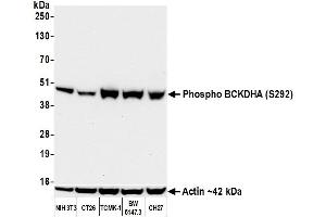 Western Blotting (WB) image for anti-Branched Chain Keto Acid Dehydrogenase E1, alpha Polypeptide (BCKDHA) (pSer292) antibody (ABIN7449282) (Recombinant BCKDHA anticorps  (pSer292))