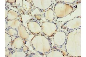 Immunohistochemistry of paraffin-embedded human thyroid tissue using ABIN7165103 at dilution of 1:100 (ARMCX6 anticorps  (AA 28-300))