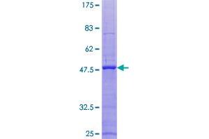 Image no. 1 for Integrin beta 3 Binding Protein (Beta3-Endonexin) (ITGB3BP) (AA 1-177) protein (GST tag) (ABIN1308207)