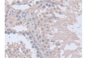 Detection of ITSN1 in Rat Testis Tissue using Polyclonal Antibody to Intersectin 1 (ITSN1)