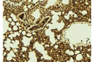 ABIN6267141 at 1/100 staining Mouse lung tissue by IHC-P. (MST1 anticorps  (pThr183))