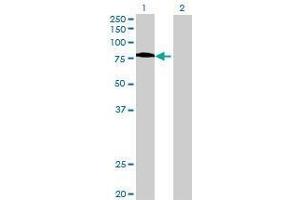 Lane 1: FEM1A transfected lysate ( 73.