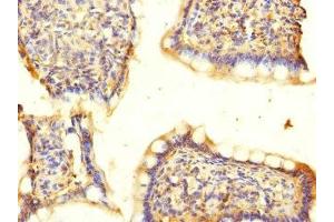 Immunohistochemistry of paraffin-embedded human small intestine tissue using ABIN7143005 at dilution of 1:100 (ACCN5 anticorps  (AA 140-330))