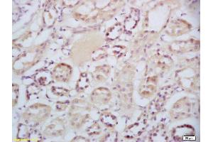 Formalin-fixed and paraffin embedded human kidney labeled with Rabbit Anti-Sclerostin Polyclonal Antibody, Unconjugated (ABIN1714867) at 1:200 followed by conjugation to the secondary antibody and DAB staining (Sclerostin anticorps  (AA 121-180))