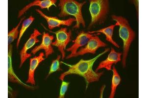HeLa cells staining with ABIN1580426 (red), and counterstained with ’s chicken polyclonal antibody to Vimentin CPCA-Vim (green) and DNA (blue).
