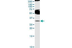 Immunoprecipitation of SLC5A1 transfected lysate using anti-SLC5A1 MaxPab rabbit polyclonal antibody and Protein A Magnetic Bead , and immunoblotted with SLC5A1 MaxPab rabbit polyclonal antibody (D01) (SLC5A1 anticorps  (AA 1-664))