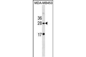 Western blot analysis in MDA-MB453 cell line lysates (35ug/lane). (CLDN14 anticorps  (C-Term))