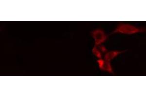 ABIN6268984 staining 293 cells by IF/ICC.