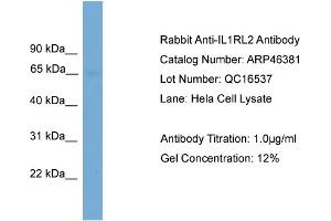 WB Suggested Anti-IL1RL2  Antibody Titration: 0. (IL1RL2 anticorps  (N-Term))