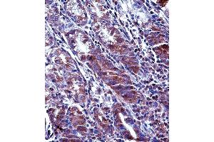 MCL1 Antibody (Center) (ABIN657627 and ABIN2846623) immunohistochemistry analysis in formalin fixed and paraffin embedded human stomach tissue followed by peroxidase conjugation of the secondary antibody and DAB staining.