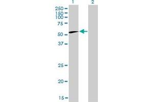 Western Blot analysis of CCT6B expression in transfected 293T cell line by CCT6B monoclonal antibody (M01), clone 1A4.