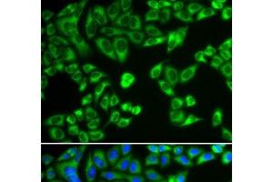 Immunofluorescence analysis of HeLa cells using SH2B1 Polyclonal Antibody