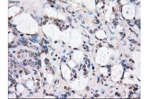 Image no. 2 for anti-Budding Uninhibited By Benzimidazoles 1 Homolog beta (Yeast) (BUB1B) antibody (ABIN1496995) (BUB1B anticorps)