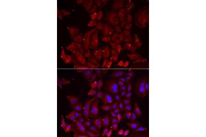 Immunofluorescence analysis of U2OS cell using PANX1 antibody. (PANX1 anticorps)