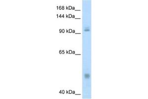 Western Blotting (WB) image for anti-Nuclear Factor of kappa Light Polypeptide Gene Enhancer in B-Cells 1 (NFKB1) antibody (ABIN2461714) (NFKB1 anticorps)