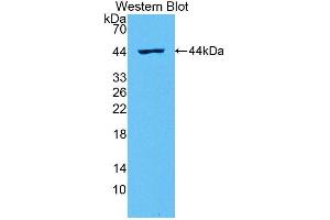 Detection of Recombinant IL2, Rat using Polyclonal Antibody to Interleukin 2 (IL2) (IL-2 anticorps  (AA 21-155))
