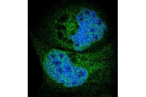 Immunofluorescent staining of A-431 cells with SYVN1 polyclonal antibody  (Green) shows positivity in endoplasmic reticulum and nucleus but excluded from the nucleoli. (SYVN1 anticorps)