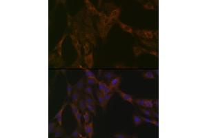 Immunofluorescence analysis of C6 cells using DDX6 Rabbit mAb (ABIN7266703) at dilution of 1:100 (40x lens). (DDX6 anticorps)