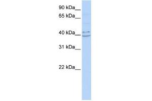 WB Suggested Anti-PYHIN1 Antibody Titration:  0. (PYHIN1 anticorps  (N-Term))