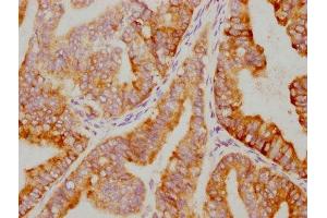 IHC image of ABIN7127641 diluted at 1:79.