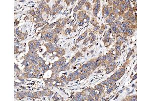 IHC analysis of Glycogen synthase 1/GYS1 using anti-Glycogen synthase 1/GYS1 antibody (ABIN7602155).